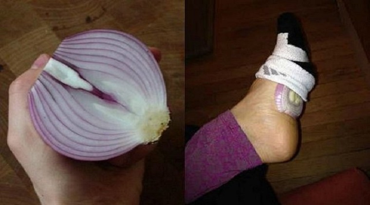 Je Me Suis Endormi Avec Un Oignon Dans Ma Chaussette Et Voici Ce Qui S 